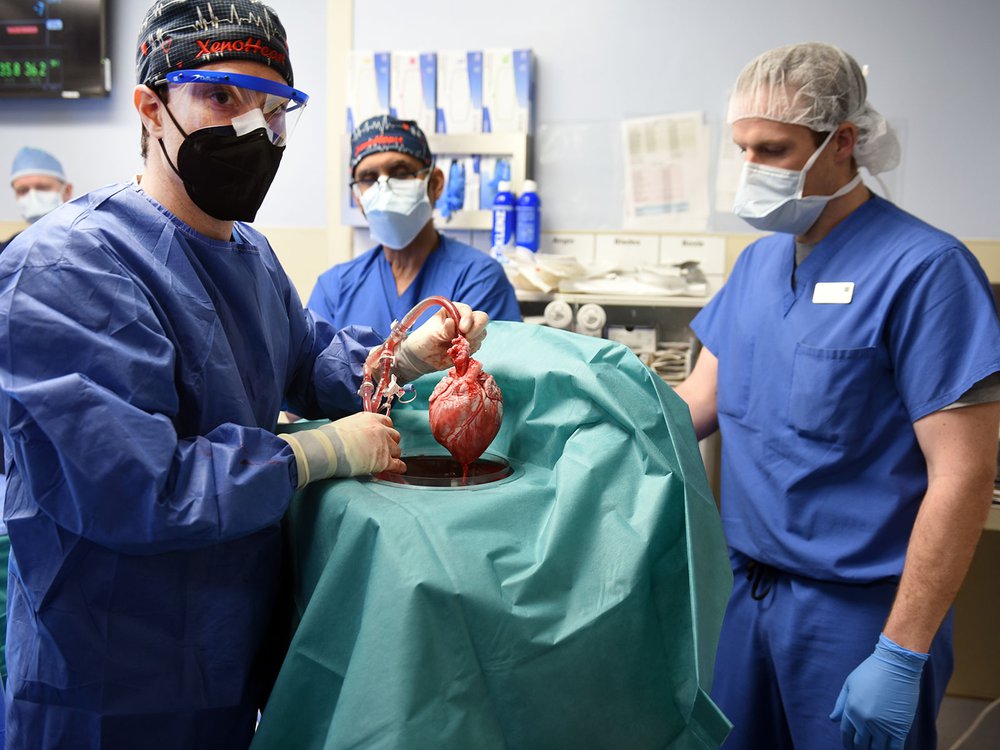 Pig Heart to Human Transplant