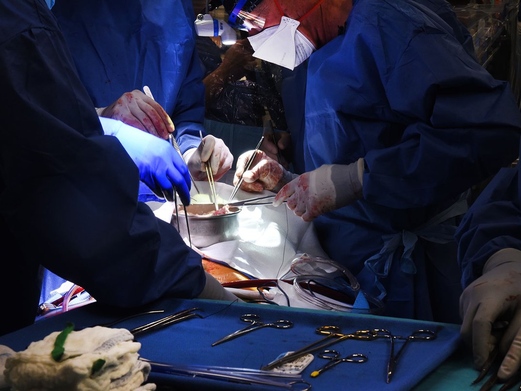 Surgeons Transplant a Pig Heart Into a Human